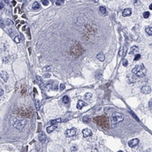 Anti-SLC6A2 