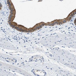 Anti-SLC6A6 antibody produced in rabbit 