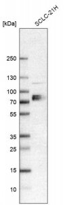 Anti-SLC7A1 antibody produced in rabbit HPA039721-100UL
