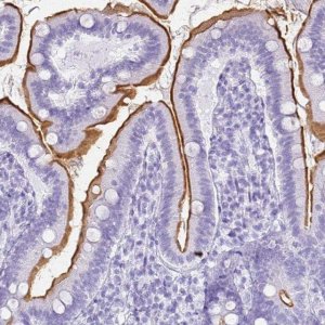 Anti-SLC7A9 antibody produced in rabbit 