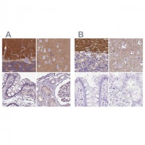 Anti-SLC8A2 antibody produced in rabbit 
