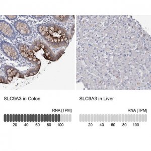 Anti-SLC9A3 antibody produced in rabbit 