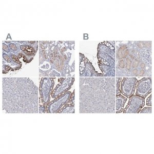 Anti-SLC9A3 antibody produced in rabbit 