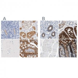 Anti-SLC9A3R1 antibody produced in rabbit 