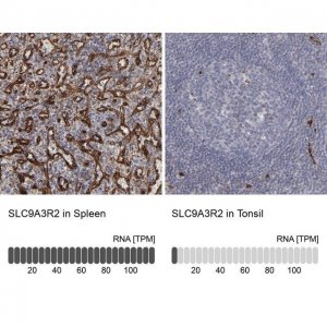 Anti-SLC9A3R2 antibody produced in rabbit 