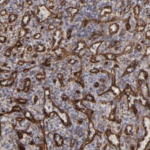 Anti-SLC9A3R2 antibody produced in rabbit 