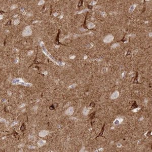 Anti-SLC9A6 antibody produced in rabbit 