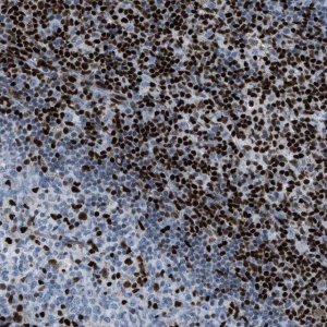 Anti-SLFN5 antibody produced in rabbit 