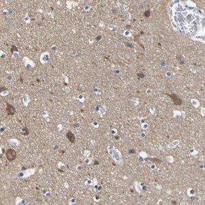 Anti-SLITRK1 antibody produced in rabbit 