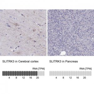 Anti-SLITRK3 