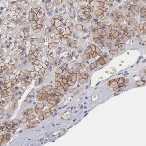 Anti-SLITRK4 antibody produced in rabbit 
