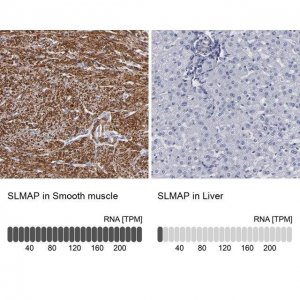 Anti-SLMAP antibody produced in rabbit 