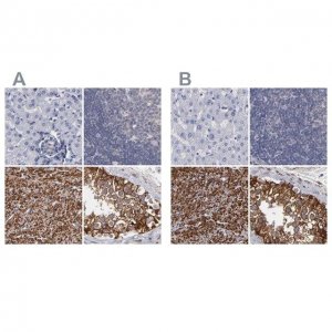 Anti-SLMAP antibody produced in rabbit 