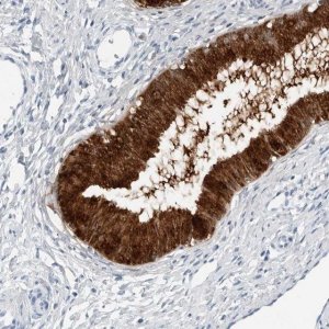 Anti-SLPI antibody produced in rabbit HPA027774-100UL