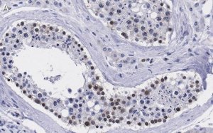 Anti-Smad1 Antibody, clone 1B9 ZooMAb Rabbit Monoclonal 