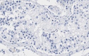Anti-Smad1 Antibody, clone 1B9 ZooMAb Rabbit Monoclonal 
