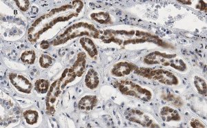 Anti-Smad3 Antibody, clone 1J11, ZooMAb Rabbit Monoclonal 