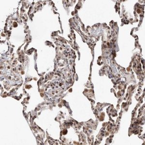 Anti-SMAD7 antibody produced in rabbit 