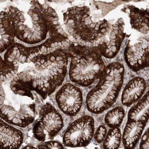 Anti-SMAP1 antibody produced in rabbit 