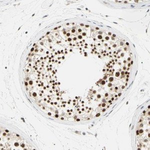 Anti-SMARCA5 antibody produced in rabbit 