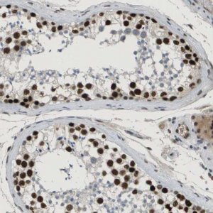 Anti-SMARCAD1 antibody produced in rabbit 