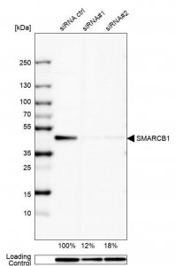 Anti-SMARCB1 antibody produced in rabbit 