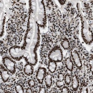 Anti-SMARCB1 antibody produced in rabbit 
