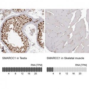 Anti-SMARCC1 antibody produced in rabbit HPA026853-100UL