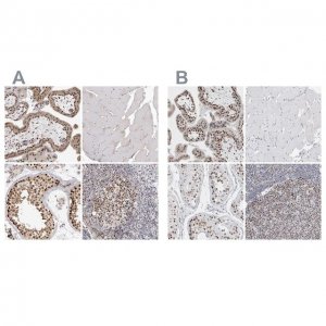 Anti-SMARCC1 antibody produced in rabbit HPA026853-100UL