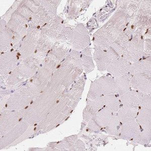 Anti-SMARCD3 antibody produced in rabbit 