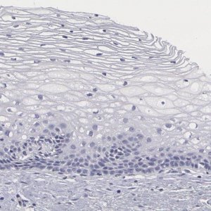 Anti-SMC1B antibody produced in rabbit 
