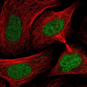 Anti-SMC3 antibody produced in rabbit HPA043206-100UL