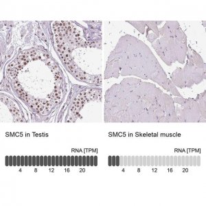 Anti-SMC5 antibody produced in rabbit 