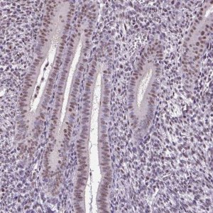 Anti-SMC5 antibody produced in rabbit 
