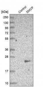Anti-SMCP antibody produced in rabbit HPA035105-100UL