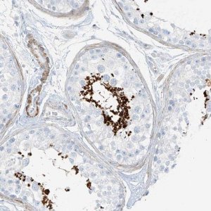 Anti-SMCP antibody produced in rabbit HPA035105-100UL