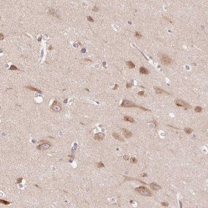 Anti-SMIM13 antibody produced in rabbit 
