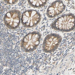 Anti-SMIM19 antibody produced in rabbit 