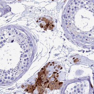 Anti-SMIM21 antibody produced in rabbit 