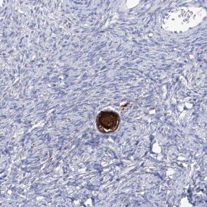 Anti-SMS antibody produced in rabbit 