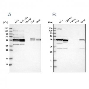 Anti-SMU1 antibody produced in rabbit 