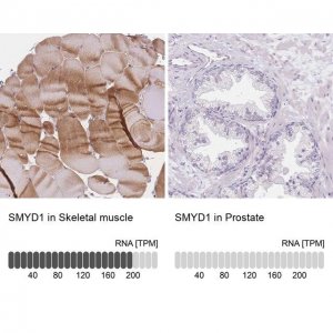 Anti-SMYD1 antibody produced in rabbit HPA062282-100UL