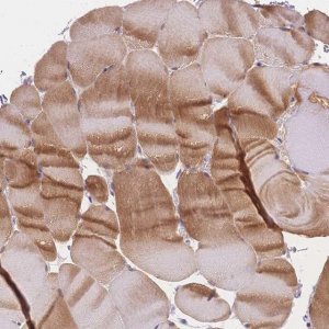 Anti-SMYD1 antibody produced in rabbit HPA062282-100UL