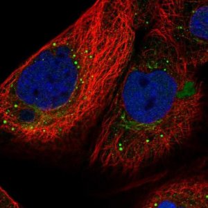 Anti-SMYD4 antibody produced in rabbit 