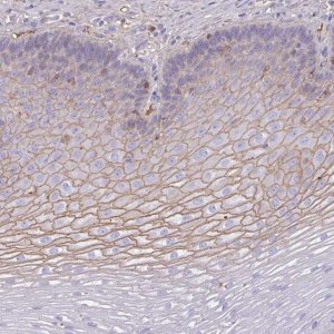 Anti-SMYD5 antibody produced in rabbit HPA049002-100UL