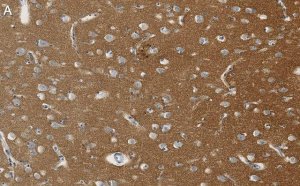 Anti-SNAP-25 Antibody, clone 1J9 ZooMAb Rabbit Monoclonal 