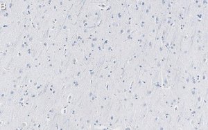 Anti-SNAP-25 Antibody, clone 1J9 ZooMAb Rabbit Monoclonal 