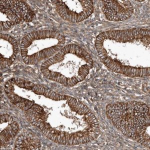 Anti-SNAP47 antibody produced in rabbit 