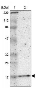 Anti-SNCA antibody produced in rabbit 