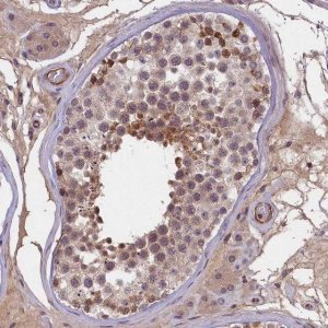 Anti-SNRK antibody produced in rabbit 
